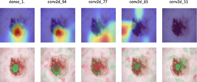 Figure 2 for Deep neural network or dermatologist?