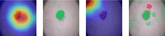 Figure 3 for Deep neural network or dermatologist?