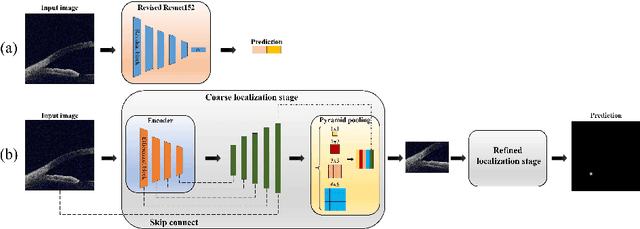 Figure 3 for Identification of primary angle-closure on AS-OCT images with Convolutional Neural Networks