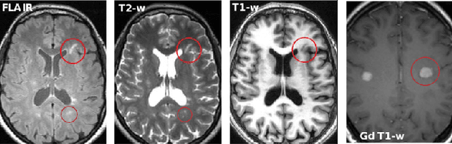 Figure 1 for Multiple Sclerosis Lesion Analysis in Brain Magnetic Resonance Images: Techniques and Clinical Applications