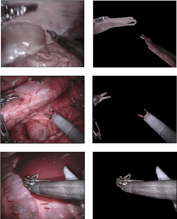 Figure 1 for Towards Unsupervised Learning for Instrument Segmentation in Robotic Surgery with Cycle-Consistent Adversarial Networks
