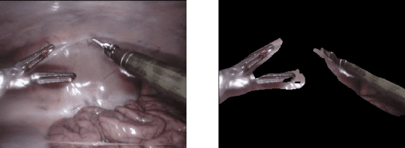 Figure 3 for Towards Unsupervised Learning for Instrument Segmentation in Robotic Surgery with Cycle-Consistent Adversarial Networks