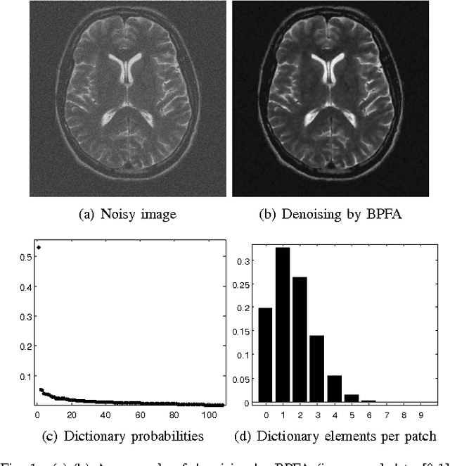 Figure 1 for Bayesian Nonparametric Dictionary Learning for Compressed Sensing MRI