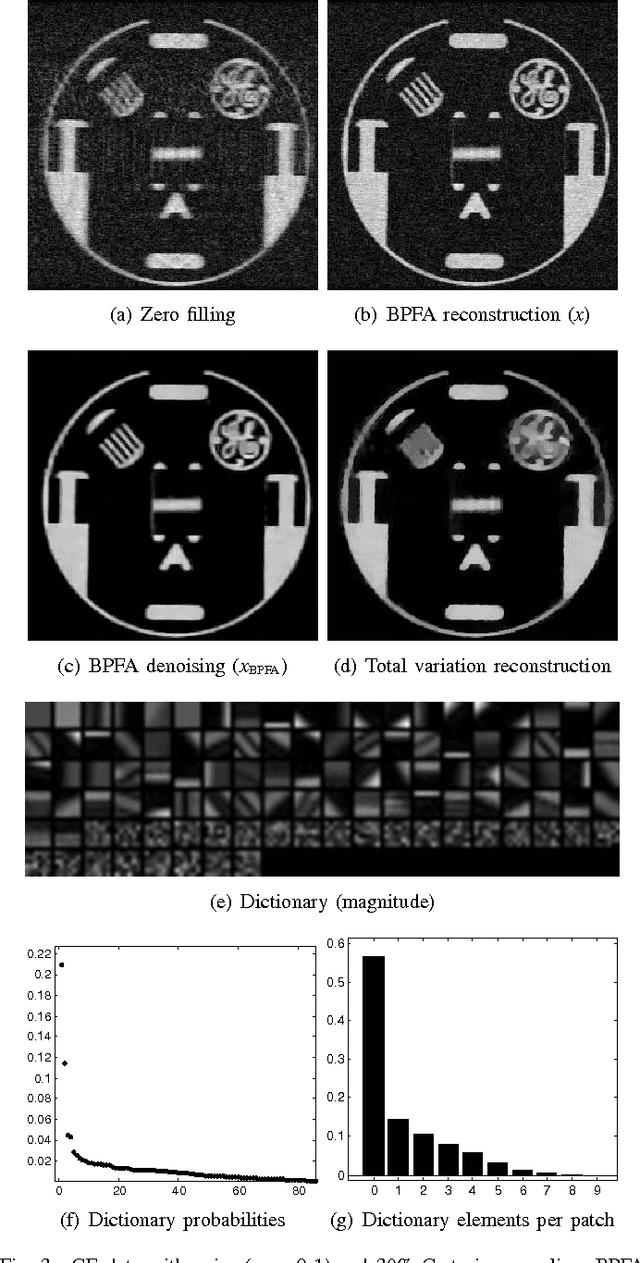 Figure 4 for Bayesian Nonparametric Dictionary Learning for Compressed Sensing MRI