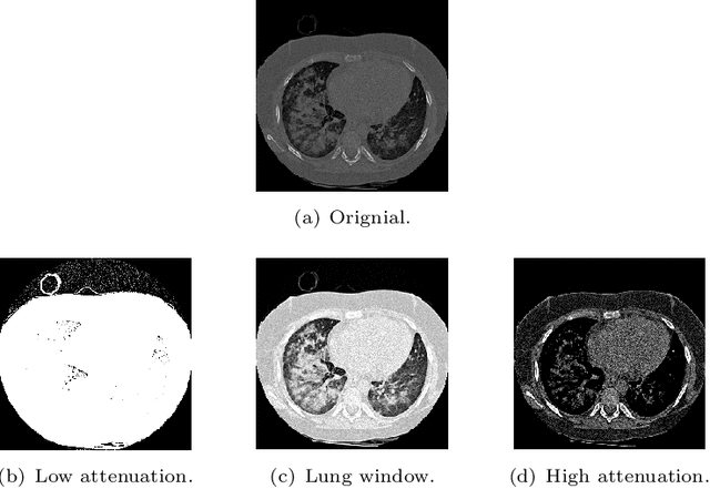 Figure 3 for CNN-based Classification Framework for Lung Tissues with Auxiliary Information
