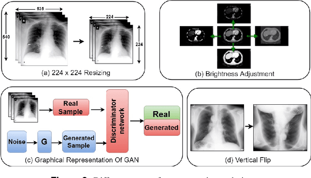 Figure 4 for A Survey of Machine Learning Techniques for Detecting and Diagnosing COVID-19 from Imaging