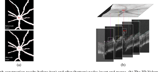 Figure 3 for Optimal Transport-based Graph Matching for 3D retinal OCT image registration