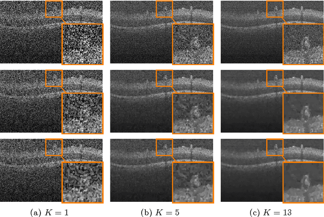 Figure 1 for QuaSI: Quantile Sparse Image Prior for Spatio-Temporal Denoising of Retinal OCT Data
