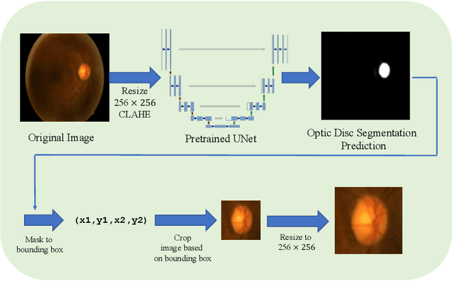 Figure 1 for RADNet: Ensemble Model for Robust Glaucoma Classification in Color Fundus Images