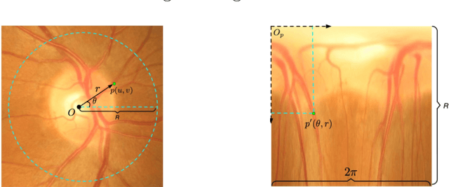 Figure 3 for RADNet: Ensemble Model for Robust Glaucoma Classification in Color Fundus Images