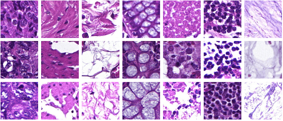 Figure 1 for Fast whole-slide cartography in colon cancer histology using superpixels and CNN classification