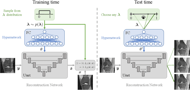 Figure 1 for Computing Multiple Image Reconstructions with a Single Hypernetwork