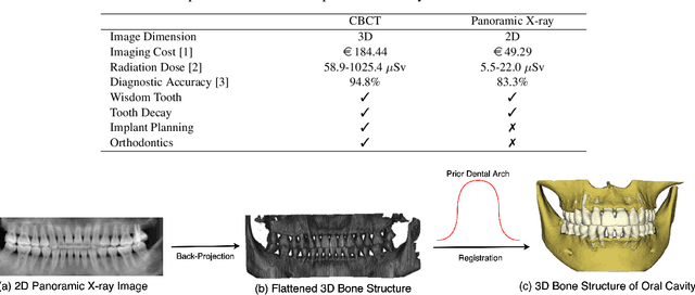 Figure 1 for Oral-3D: Reconstructing the 3D Bone Structure of Oral Cavity from 2D Panoramic X-ray
