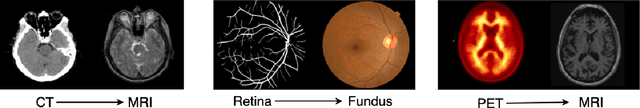 Figure 2 for Oral-3D: Reconstructing the 3D Bone Structure of Oral Cavity from 2D Panoramic X-ray