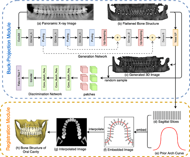 Figure 4 for Oral-3D: Reconstructing the 3D Bone Structure of Oral Cavity from 2D Panoramic X-ray