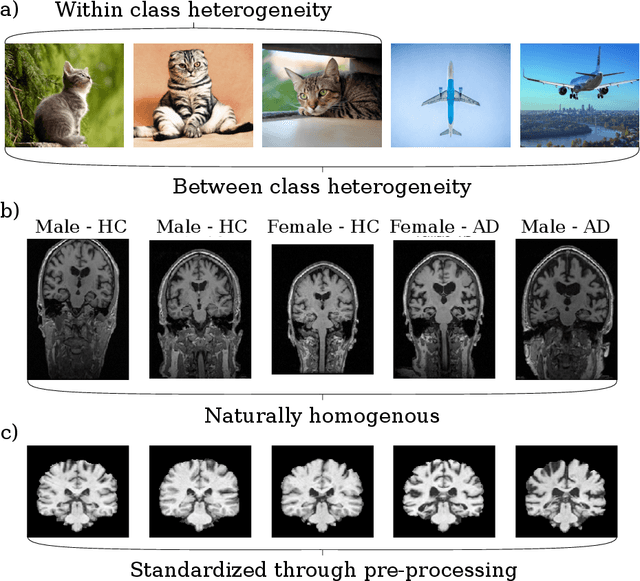 Figure 1 for Harnessing spatial homogeneity of neuroimaging data: patch individual filter layers for CNNs