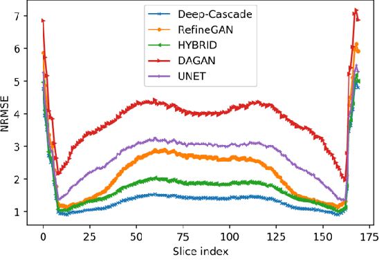 Figure 3 for A Hybrid Frequency-domain/Image-domain Deep Network for Magnetic Resonance Image Reconstruction