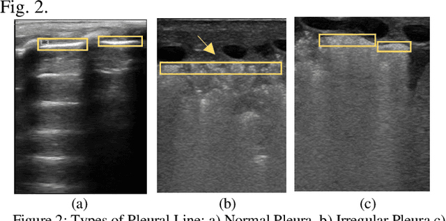 Figure 2 for An interpretable object detection based model for the diagnosis of neonatal lung diseases using Ultrasound images