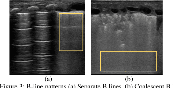 Figure 3 for An interpretable object detection based model for the diagnosis of neonatal lung diseases using Ultrasound images