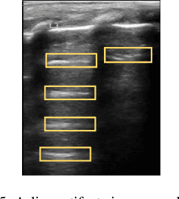 Figure 4 for An interpretable object detection based model for the diagnosis of neonatal lung diseases using Ultrasound images