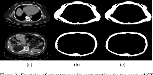 Figure 3 for Adipose Tissue Segmentation in Unlabeled Abdomen MRI using Cross Modality Domain Adaptation