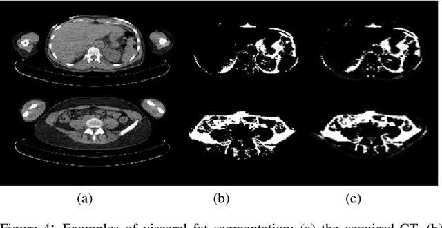 Figure 4 for Adipose Tissue Segmentation in Unlabeled Abdomen MRI using Cross Modality Domain Adaptation