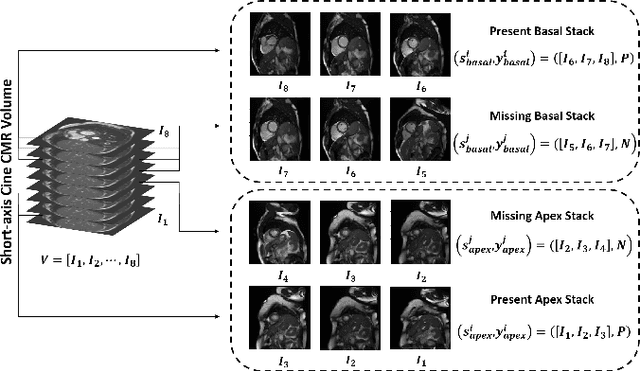 Figure 1 for Fully Automated Assessment of Cardiac Coverage in Cine Cardiovascular Magnetic Resonance Images using an Explainable Deep Visual Salient Region Detection Model