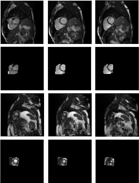 Figure 4 for Fully Automated Assessment of Cardiac Coverage in Cine Cardiovascular Magnetic Resonance Images using an Explainable Deep Visual Salient Region Detection Model