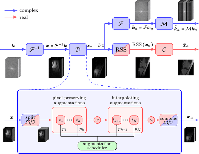 Figure 1 for Data augmentation for deep learning based accelerated MRI reconstruction with limited data