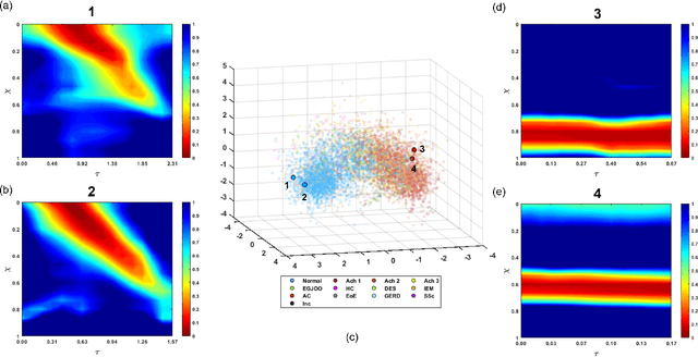 Figure 4 for Esophageal virtual disease landscape using mechanics-informed machine learning