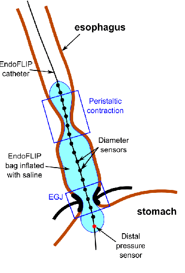 Figure 1 for Esophageal virtual disease landscape using mechanics-informed machine learning