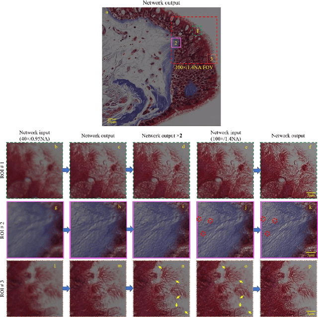 Figure 2 for Deep Learning Microscopy