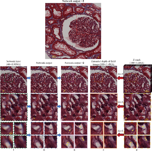 Figure 3 for Deep Learning Microscopy