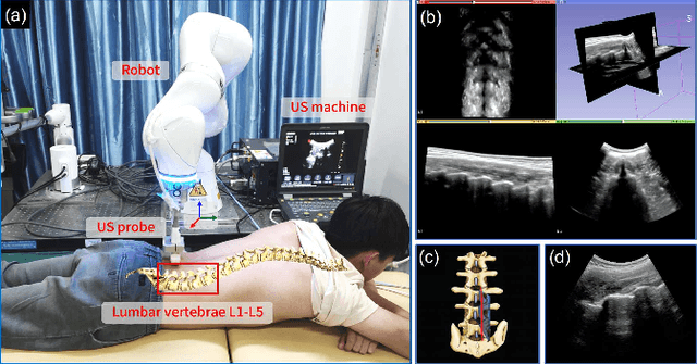 Figure 2 for Autonomous Navigation of an Ultrasound Probe Towards Standard Scan Planes with Deep Reinforcement Learning