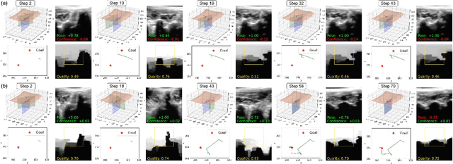 Figure 4 for Autonomous Navigation of an Ultrasound Probe Towards Standard Scan Planes with Deep Reinforcement Learning