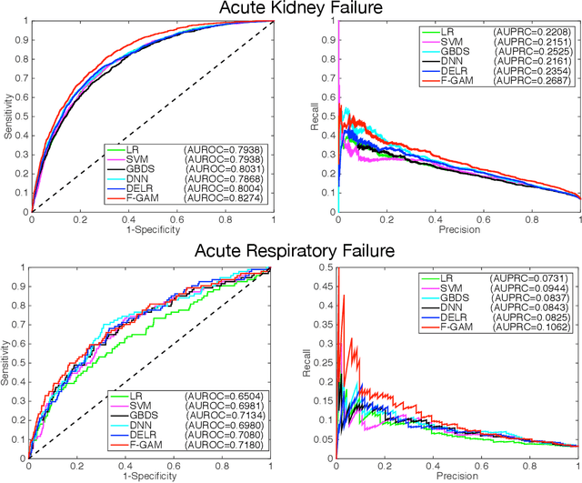 Figure 4 for A Factored Generalized Additive Model for Clinical Decision Support in the Operating Room