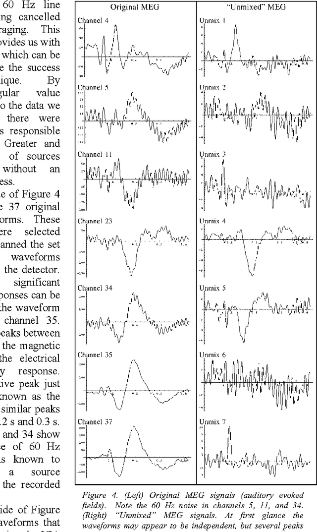Figure 4 for Difficulties applying recent blind source separation techniques to EEG and MEG