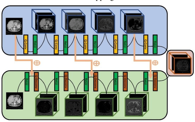 Figure 1 for Quadratic Autoencoder for Low-Dose CT Denoising