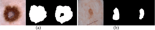 Figure 1 for Complementary Network with Adaptive Receptive Fields for Melanoma Segmentation