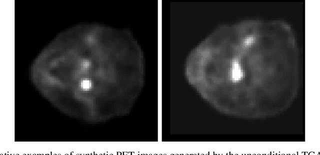 Figure 1 for 3-D PET Image Generation with tumour masks using TGAN