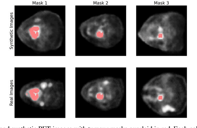 Figure 4 for 3-D PET Image Generation with tumour masks using TGAN