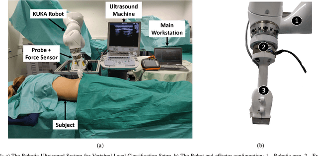 Figure 1 for Force-Ultrasound Fusion: Bringing Spine Robotic-US to the Next "Level"