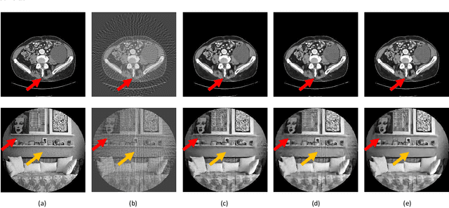 Figure 4 for Dual Network Architecture for Few-view CT -- Trained on ImageNet Data and Transferred for Medical Imaging