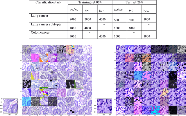 Figure 2 for Prediction of lung and colon cancer through analysis of histopathological images by utilizing Pre-trained CNN models with visualization of class activation and saliency maps