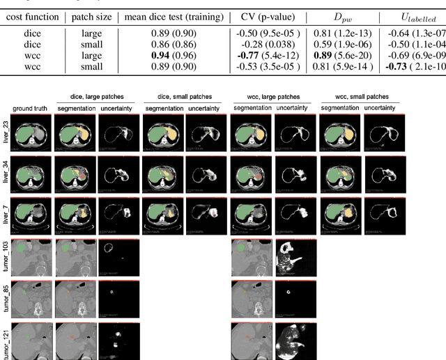 Figure 1 for Give me (un)certainty -- An exploration of parameters that affect segmentation uncertainty