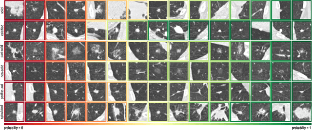 Figure 4 for Towards automatic pulmonary nodule management in lung cancer screening with deep learning