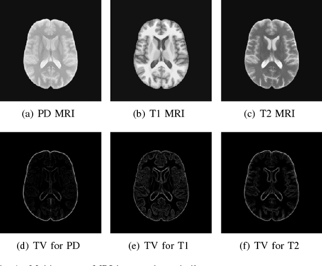 Figure 1 for A Deep Information Sharing Network for Multi-contrast Compressed Sensing MRI Reconstruction