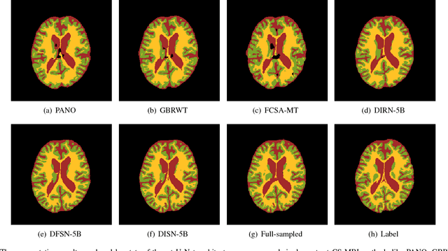 Figure 3 for A Deep Information Sharing Network for Multi-contrast Compressed Sensing MRI Reconstruction