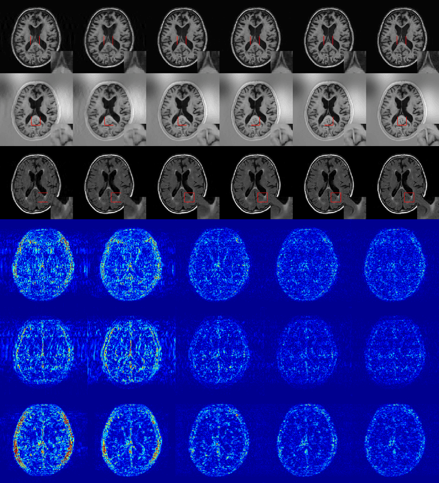 Figure 2 for A Deep Information Sharing Network for Multi-contrast Compressed Sensing MRI Reconstruction
