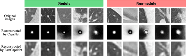 Figure 4 for Fast CapsNet for Lung Cancer Screening